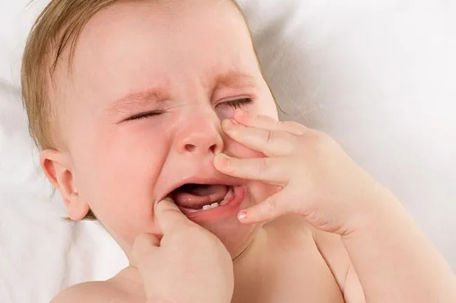 Răng bé mọc chậm lại dễ bị sâu, Mẹ nên làm gì ?