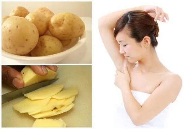 C&aacute;ch trị th&acirc;m n&aacute;ch tại nh&agrave; bằng khoai t&acirc;y