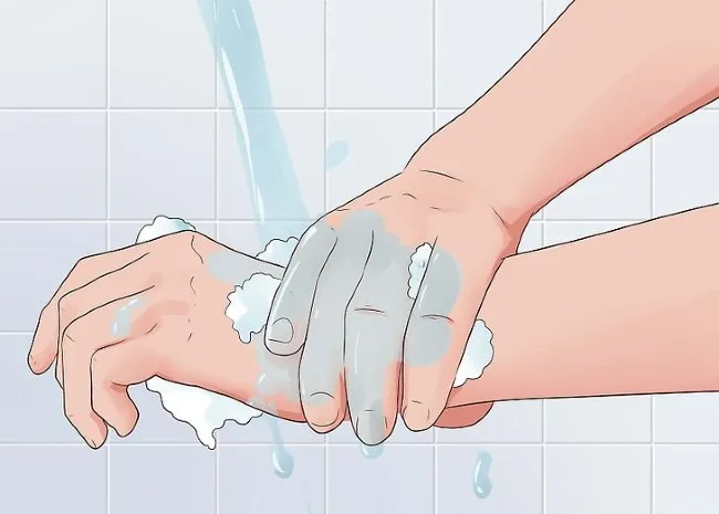 L&agrave;m sạch vết thương khi bị trầy ng&atilde; xe