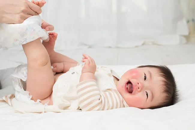 c&aacute;ch sử dụng kem Sudocrem
