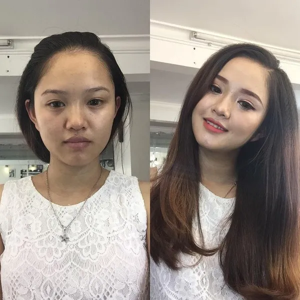 Sự thay đổi của nội tiết tố trong cơ thể khiến chị em khi mang thai thường c&oacute; l&agrave;n da sạm m&agrave;u