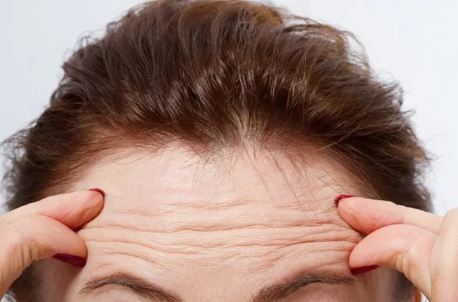 ưu &dstrok;iểm của lactic acid gi&uacute;p giảm nếp nhăn v&agrave; đường nhăn tr&ecirc;n da