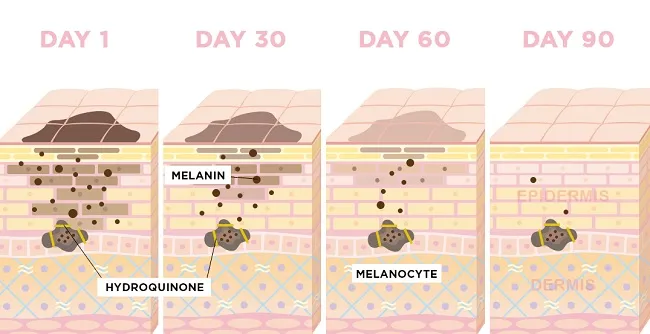 Cơ chế hoạt động của hydroquinone