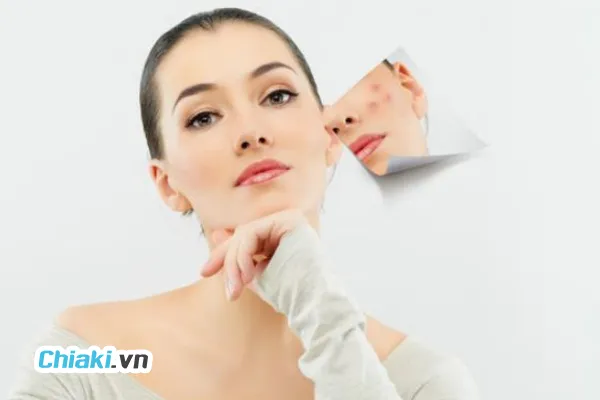[Review] Top 9 Kem Trị Mụn Ở Hiệu Thuốc Tốt Hiện Nay