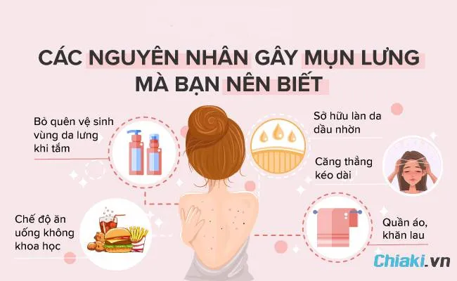 Nguy&ecirc;n nh&acirc;n khiến lưng dễ bị nổi mụn