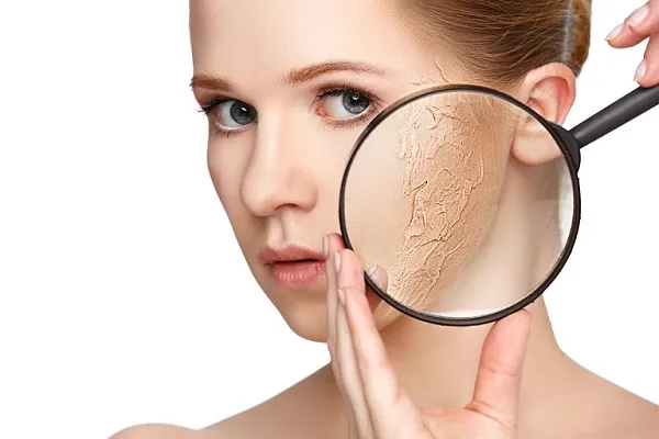 Đặc điểm của l&agrave;n da kh&ocirc;
