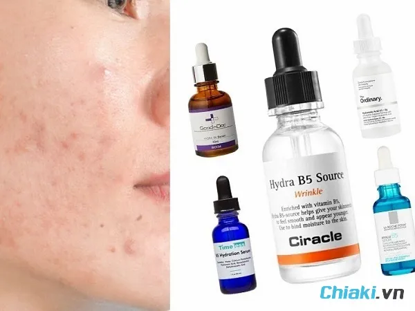 Hydra B5 Serum mang đến lợi &iacute;ch g&igrave; cho da?