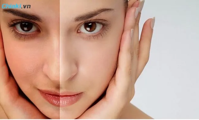 Nguy&ecirc;n nh&acirc;n khiến da bị xỉn m&agrave;u, kh&ocirc;ng trắng s&aacute;ng