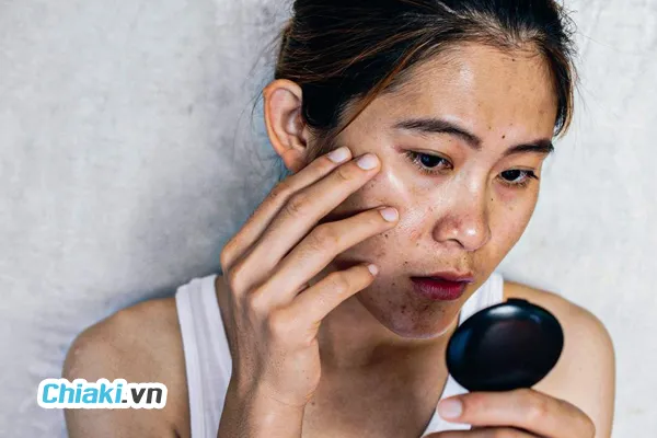 Nguy&ecirc;n nh&acirc;n khiến da sạm m&agrave;u v&agrave; đen da