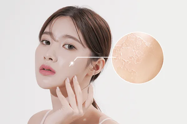 Đối tượng n&ecirc;n sử dụng vi&ecirc;n uống cấp nước