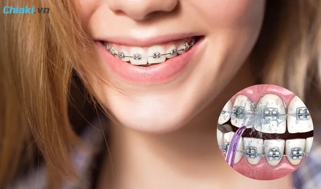 Sử dụng kết hợp th&ecirc;m m&aacute;y tăm nước để l&agrave;m sạch mảng b&aacute;m hiệu quả