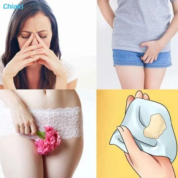 Triệu chứng nhiễm nấm Candida &acirc;m đạo&nbsp;