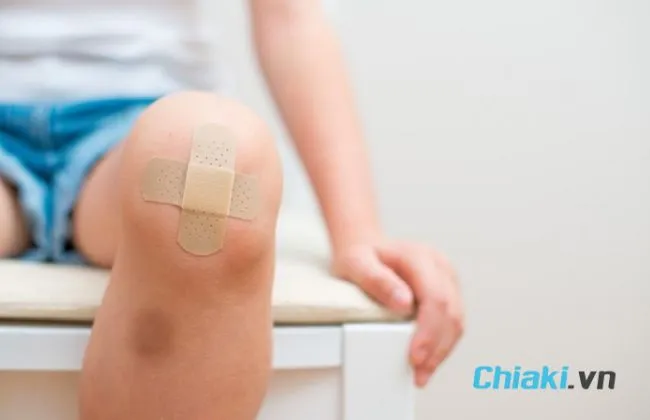 Collagen c&oacute; ưu điểm g&igrave; với vết thương