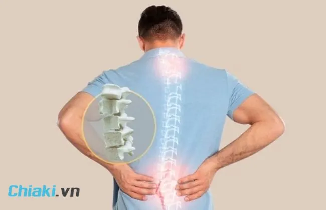 Collagen gi&uacute;p ngăn ngừa lo&atilde;ng xương