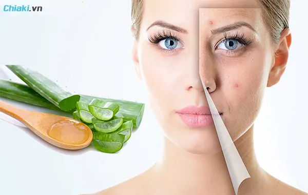 mặt nạ lột mụn bằng nha đam