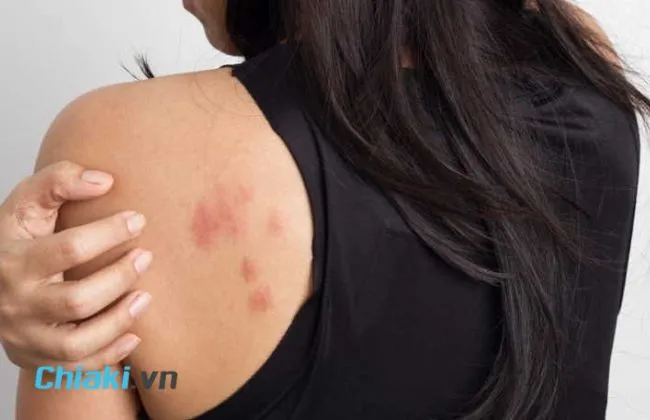 ưu điểm phụ khi bổ sung collagen