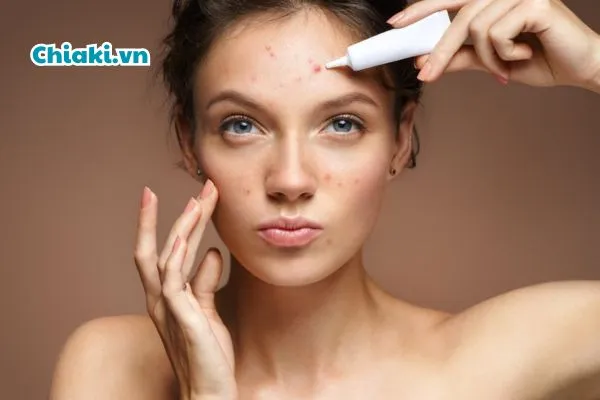 C&aacute;ch chọn kem trị mụn đầu đen hiệu quả