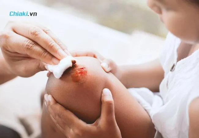 Dấu hiệu trầy xước da