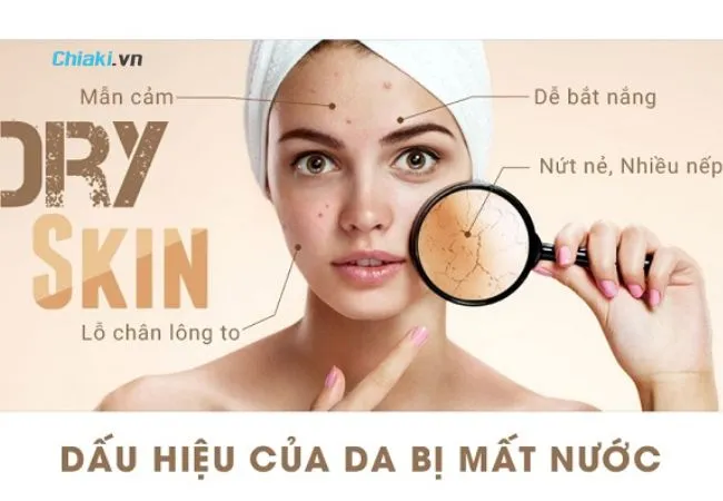 Da kh&ocirc; l&agrave; g&igrave;? C&aacute;ch nhận biết da kh&ocirc;