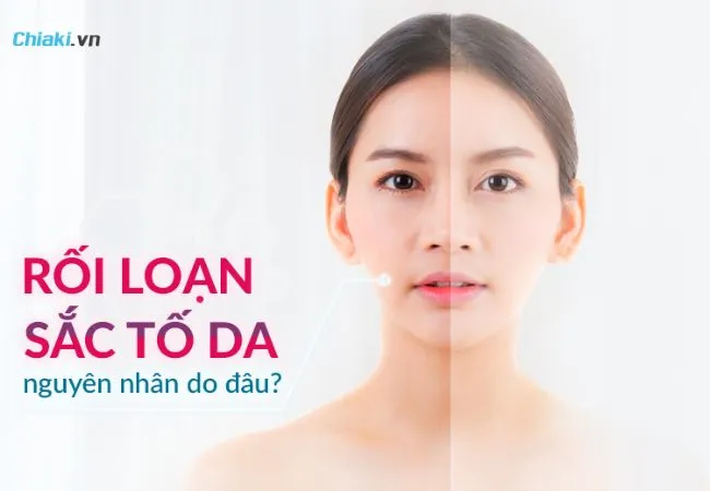 Rối loạn sắc tố melanin g&acirc;y hại g&igrave; cho sức khỏe của l&agrave;n da?