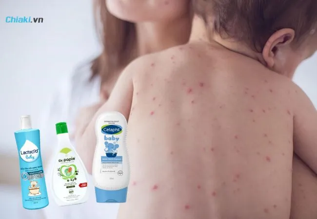 Tầm quan trọng chọn sữa tắm ph&ugrave; hợp cho trẻ bị vi&ecirc;m da cơ địa