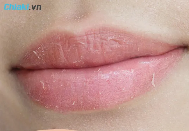 sử dụng son dưỡng m&ocirc;i sau xăm khi m&ocirc;i bong