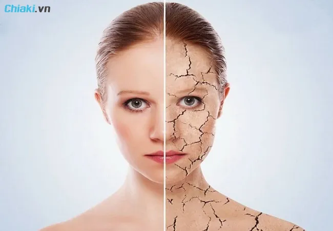 ưu điểm của retinol đối với l&agrave;n da kh&ocirc;