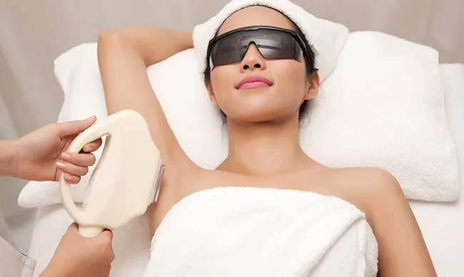 Trị th&acirc;m n&aacute;ch bằng laser thẩm mỹ