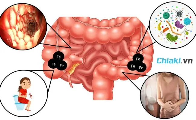 Người c&oacute; vấn đề về ti&ecirc;u h&oacute;a n&ecirc;n thận trọng khi uống sắt
