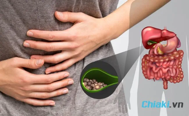 Những ai kh&ocirc;ng n&ecirc;n uống sắt - Người bị sỏi mật