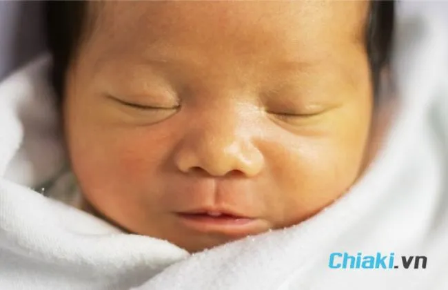 C&aacute;ch chăm s&oacute;c trẻ sơ sinh bị v&agrave;ng da