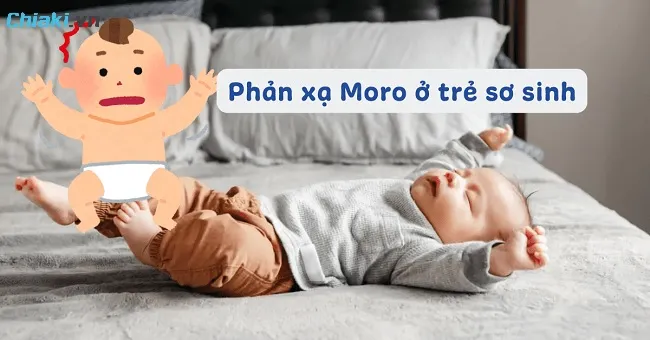 Hiện tượng b&eacute; giật m&igrave;nh khi ngủ thường c&oacute; li&ecirc;n quan tới một phản xạ gọi l&agrave; phản xạ Moro (Moro reflex)