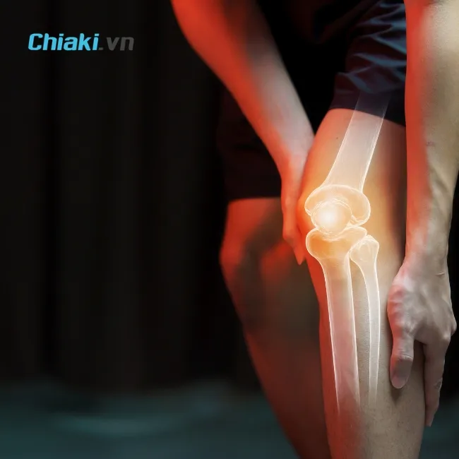 Đau khớp gối xảy ra khi cấu tr&uacute;c sụn, xương dưới sụn bị tổn thương