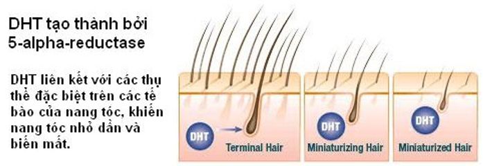 Viên uống Maxxhair hỗ trợ mọc tóc, giảm rụng tóc - Bổ sung vitamin, khoáng chất cho tóc chắc khỏe, bóng mượt