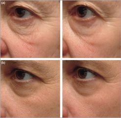 Kem Dưỡng Da Kose Q10 Vital Age 40g - Giúp Chống Lão Hóa, Cung Cấp Độ Ẩm và Tái Tạo Da, Phù Hợp Với Mọi Loại Da