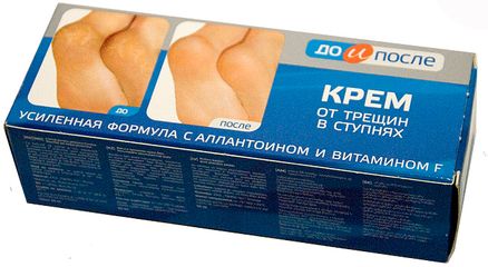 Kem hỗ trợ cải thiện nứt gót chân Kpem Apteka của Nga 50ml - Dưỡng ẩm, làm mềm da, tái tạo gót chân khỏe mạnh, không đau đớn di chuyển.