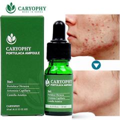 Serum Giảm Mụn và Thâm Caryophy Portulaca Ampoule 10ml - Sản Phẩm Chăm Sóc Da Từ Thiên Nhiên, Hiệu Quả Tức Thì