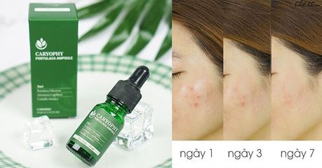 Serum Giảm Mụn và Thâm Caryophy Portulaca Ampoule 10ml - Sản Phẩm Chăm Sóc Da Từ Thiên Nhiên, Hiệu Quả Tức Thì