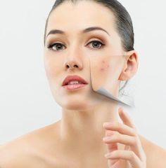 Kem Giảm Mụn Farmona Dermacos Anti Acne Matting Cream 50ml - Hỗ Trợ Điều Trị Mụn, Kháng Viêm, Giảm Bóng Nhờn Da