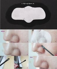 Miếng Serum Đẩy Mụn Đầu Đen Ciracle Goodbye Blackhead - Mặt Nạ Chăm Sóc Da Hàn Quốc, Giúp Làm Sạch Lỗ Chân Lông Hiệu Quả