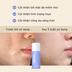 Gel Tẩy Tế Bào Chết AHA & PHA Candid 100ml - Hỗ Trợ Mịn Da, Ngừa Mụn, Dưỡng Sáng Da, Dạng Gel Dịu Nhẹ, Sản Phẩm Chăm Sóc Da Chất Lượng Cao