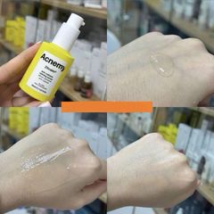 Huyết Thanh Giảm Đỏ Làm Dịu Da Acnemy Zitcalm 30ml - Serum Chăm Sóc Da Nhạy Cảm, Cấp Ẩm, Không Chứa Gluten, Thẩm Thấu Nhanh