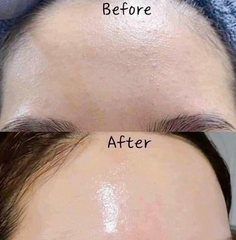Tinh Chất Dưỡng Trắng Da Melan C15 Radiance Beauva 30ml - Serum Chống Nám, Làm Sáng Da, Hỗ Trợ Ngừa Thâm, Phục Hồi Làn Da Rạng Rỡ