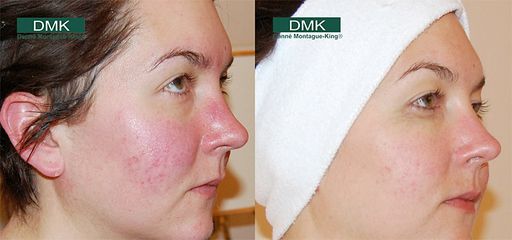 Serum Vitamin C Dưỡng Trắng DMK Direct Delivery - Tăng Cường Collagen & Chống Oxy Hóa Cho Da Sáng Mịn - Lọ 30ml