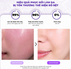 Tinh chất ốc sên Tiam Snail & Azulene Essence 180ml - Serum làm dịu và phục hồi da nhạy cảm, cấp ẩm tự nhiên hiệu quả