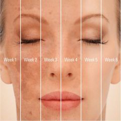 Kem Giảm Nám Trắng Da SkinMD Hàn Quốc 15ml - Giải Pháp Chống Lão Hóa, Làm Sáng Da, Phục Hồi Tổn Thương Da