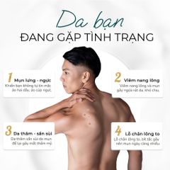Xịt Hỗ Trợ Giảm Mụn Lưng Oriskin Vicenta Body Mist cho nam