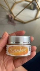 Scarmagic Giúp Làm Mờ Sẹo Và Vết Thâm Nám Hiệu Quả