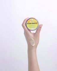 Scarmagic Giúp Làm Mờ Sẹo Và Vết Thâm Nám Hiệu Quả
