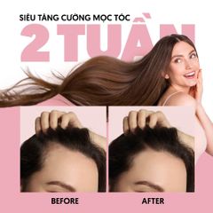 Dầu Gội Biotin & Keratin Siêu Giảm RụngTóc Tối Ưu Milaganics 240ml